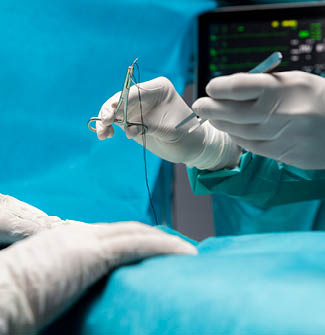 وصف مصنع خيوط جراحية